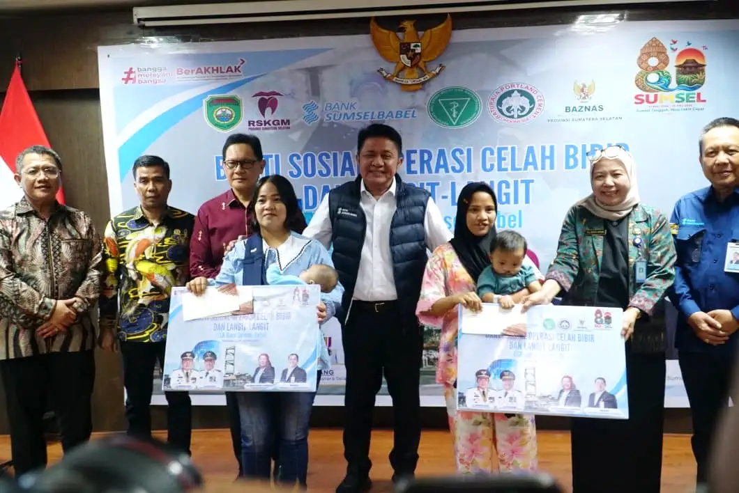 hut-sumsel-80-herman-deru-operasi-bibir-sumbing Gubernur Sumsel Herman Deru mendampingi ibu dan bayi pasien operasi celah bibir gratis di RSGM Provinsi saat HUT Sumsel ke-80.